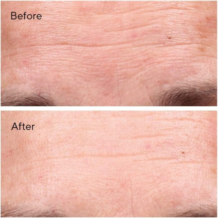 Murad Minimising Lines and Wrinkles Set: Say Goodbye to Fine Lines and Wrinkles with Cleansing Cream, Wrinkle Corrector, Serum, Night Cream - Image 8